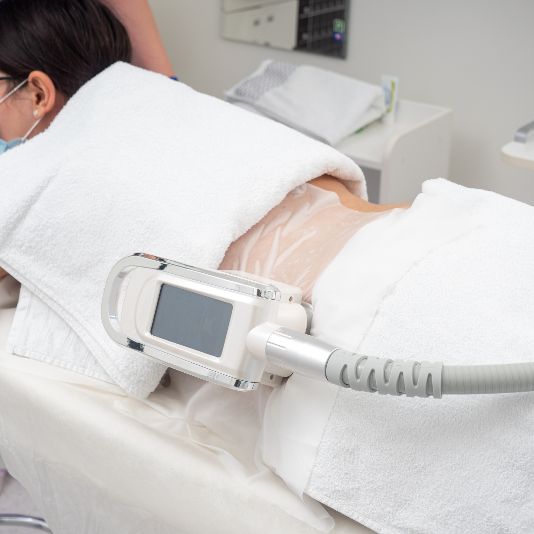 Tratament Corporal Criolipoliză CryoLipo de Slăbire Localizată prin Răcire Controlată