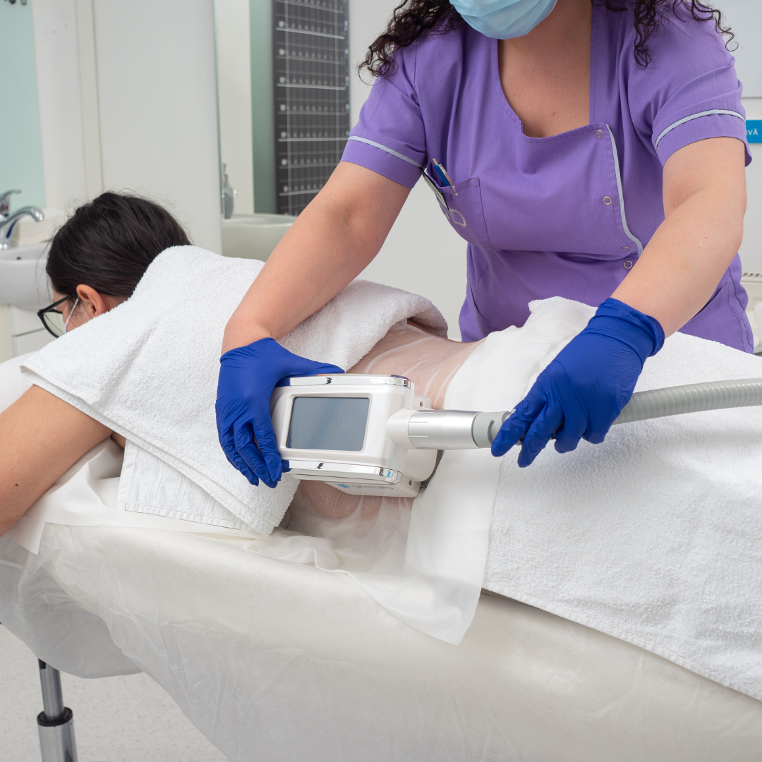 Tratament Corporal Criolipoliză CryoLipo de Slăbire Localizată prin Răcire Controlată