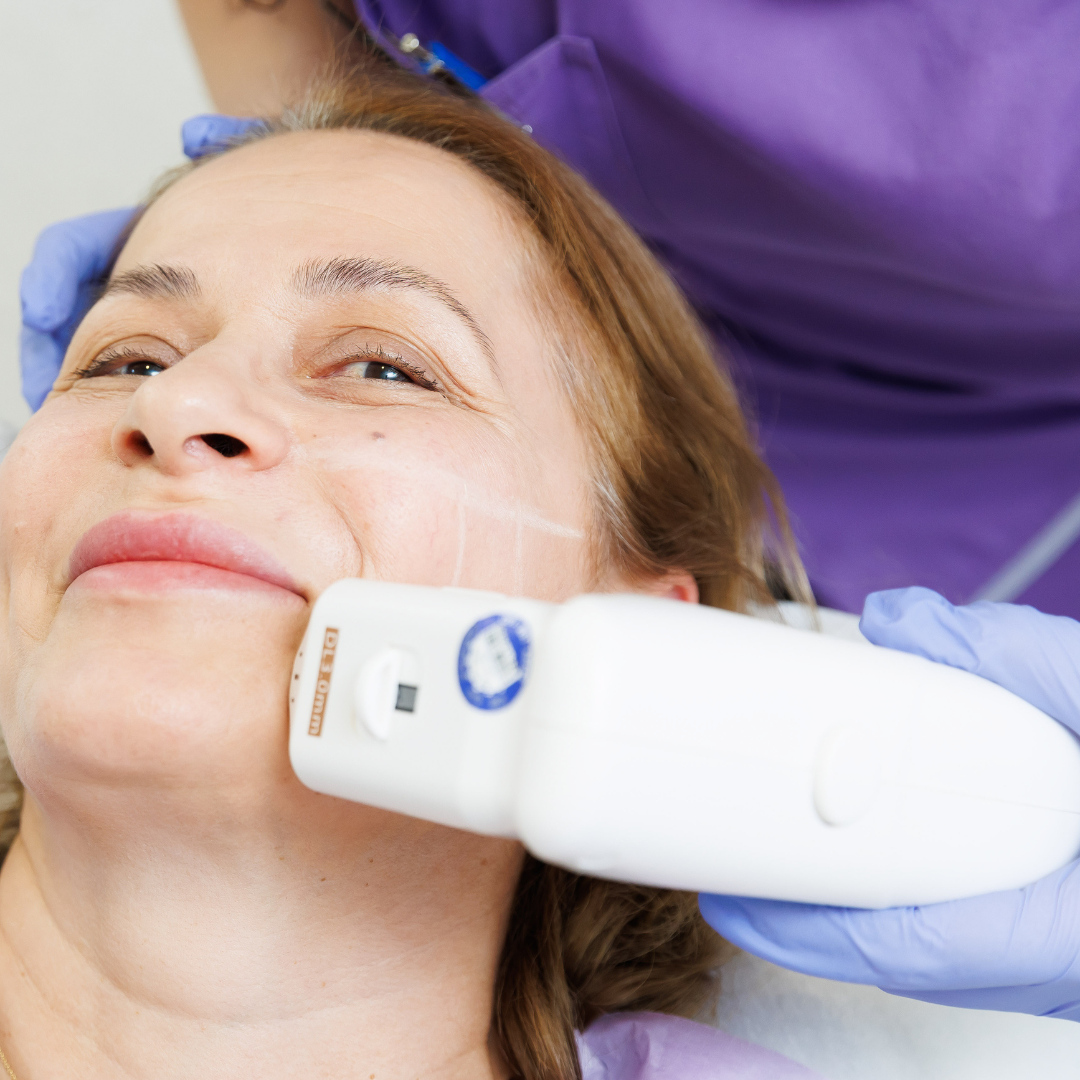 Tratament lifting facial noninvaziv FaceTight