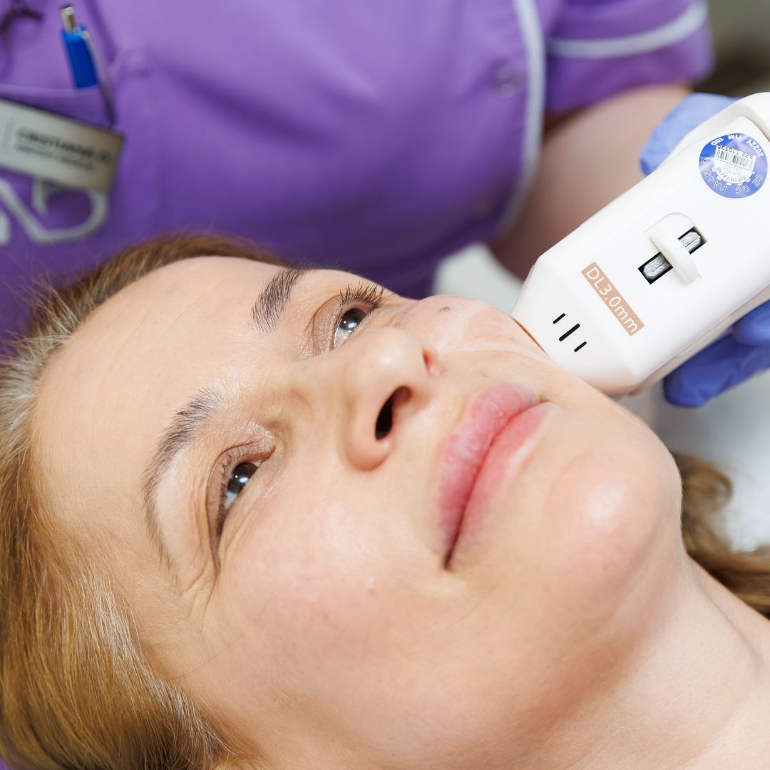 Tratament lifting facial noninvaziv FaceTight