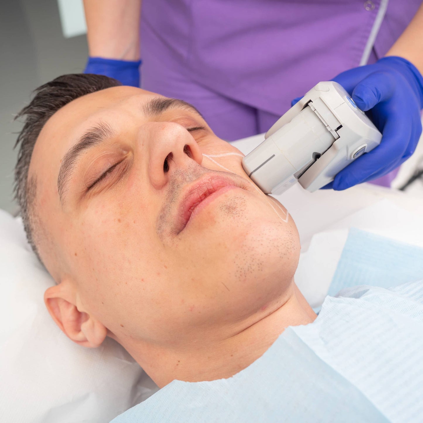 Tratament lifting facial noninvaziv FaceTight