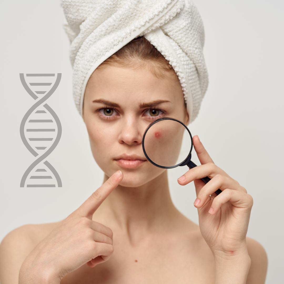 Test ADN Anti-Acnee AcneTest – tratament personalizat pentru un ten curat