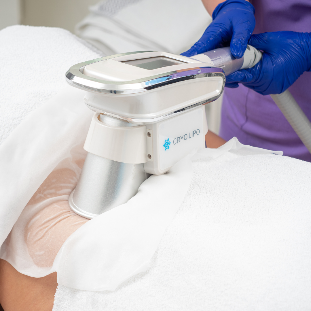 Tratament Corporal Criolipoliză CryoLipo de Slăbire Localizată prin Răcire Controlată