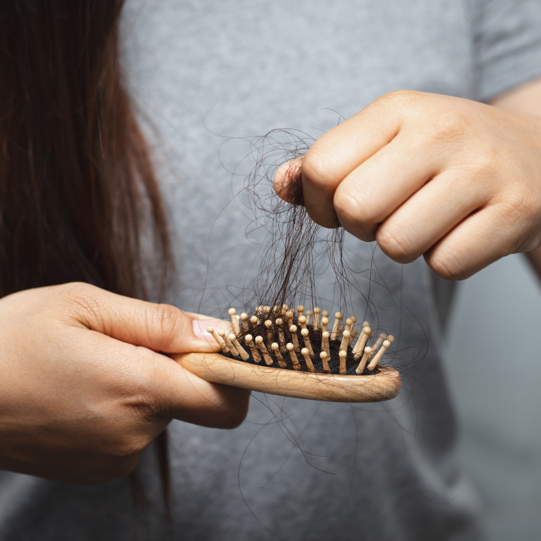 Test ADN anti-alopecie